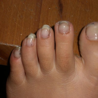 Agosto 2011